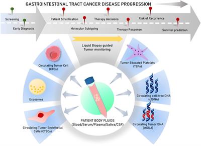 Prospects of liquid biopsy in the prognosis and clinical management of gastrointestinal cancers